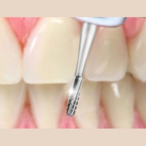 SS White karbid fúrók